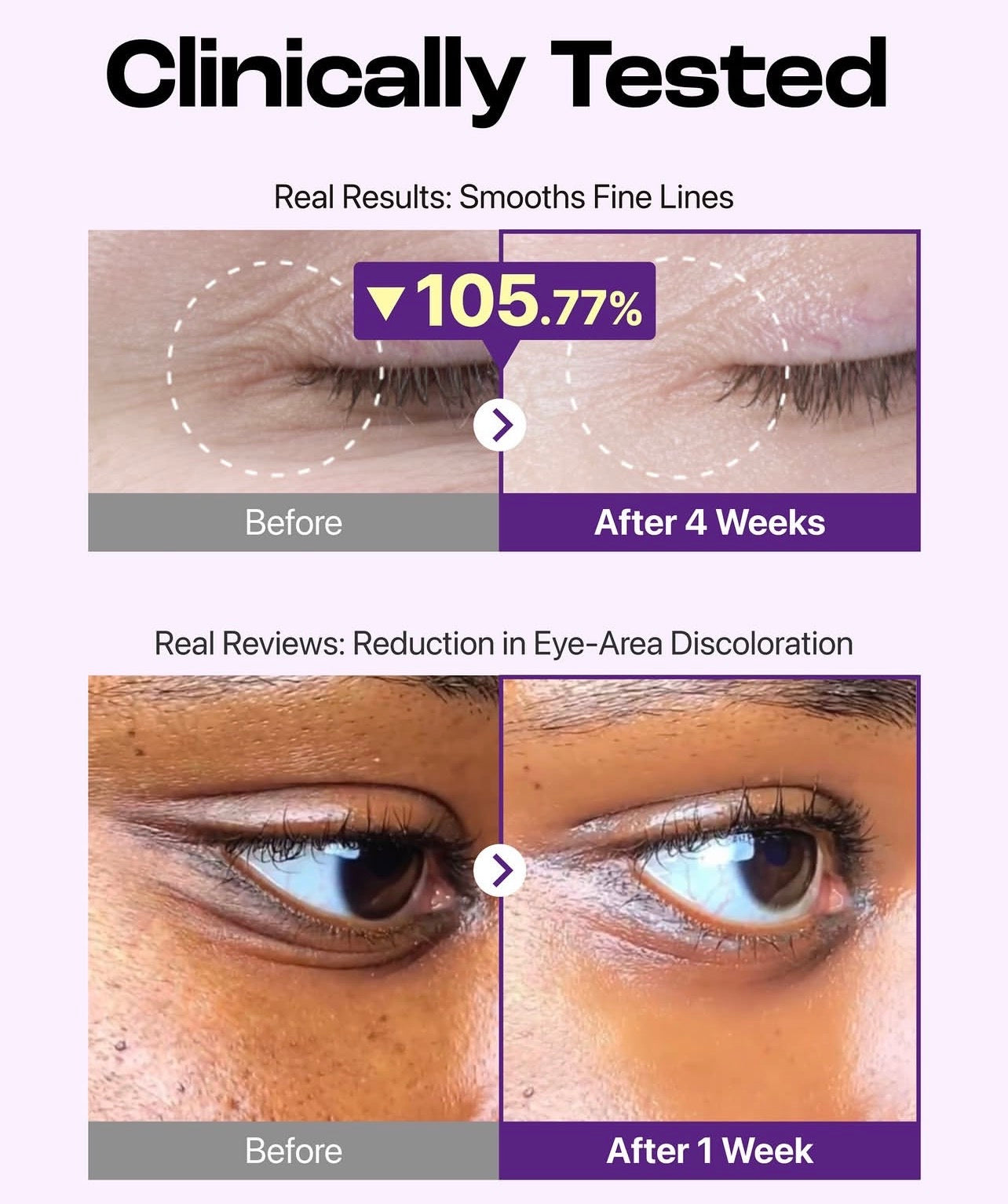 Retinol NAD+ Eye Cream